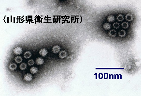 ノロウイルス（山形県衛生研究所）